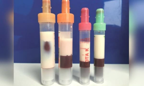 Những thực phẩm khiến máu trắng như sữa, càng ăn nhiều càng rước họa vào thân