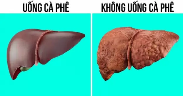 9 lợi ích bất ngờ của cà phê với sức khỏe đã được khoa học chứng minh