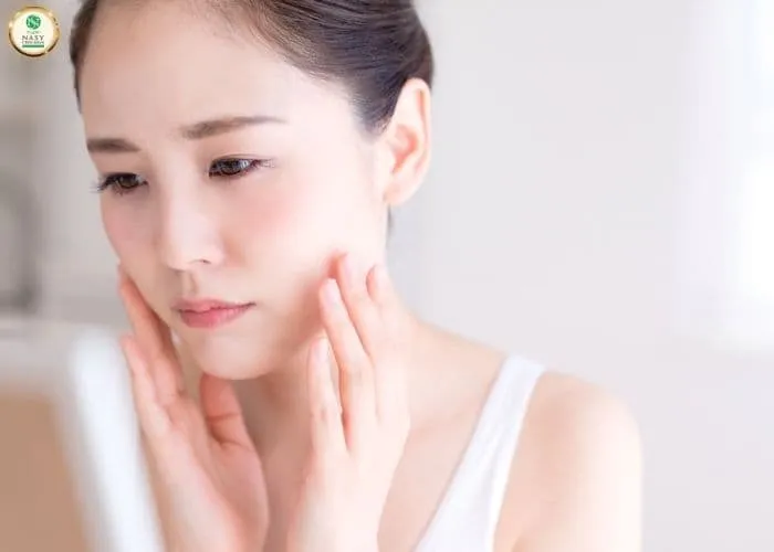 Cách trị nám tàn nhang