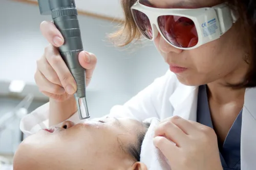 Trị nám da bằng laser có tốt không? Cơ chế hoạt động của nó như thế nào?