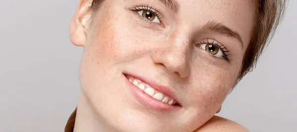 Phân biệt nám và tàn nhang bằng những dấu hiệu dễ thấy